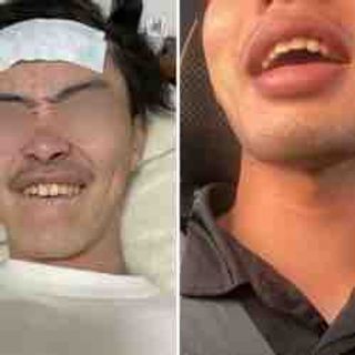 eyJidWNrZXQiOiJvcGVucmVjLWFwcGRhdGEiLCJrZXkiOiJ1c2VyLzEyMzAwNzY1LzEyMzAwNzY0NTUuanBnIiwiZWRpdHMiOnsicmVzaXplIjp7ImZpdCI6Imluc2lkZSIsIndpZHRoIjoiMzIwIn19LCJvdXRwdXRGb3JtYXQiOiJqcGcifQ==?version=1675014023